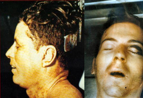 kennedy assassination autopsy pictures. The Kennedy Assassination